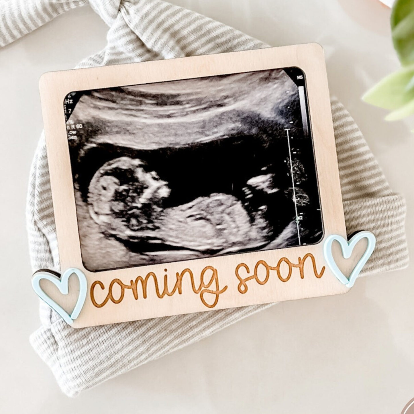 Pregnancy Announcement Ultrasound Fridge Magnet