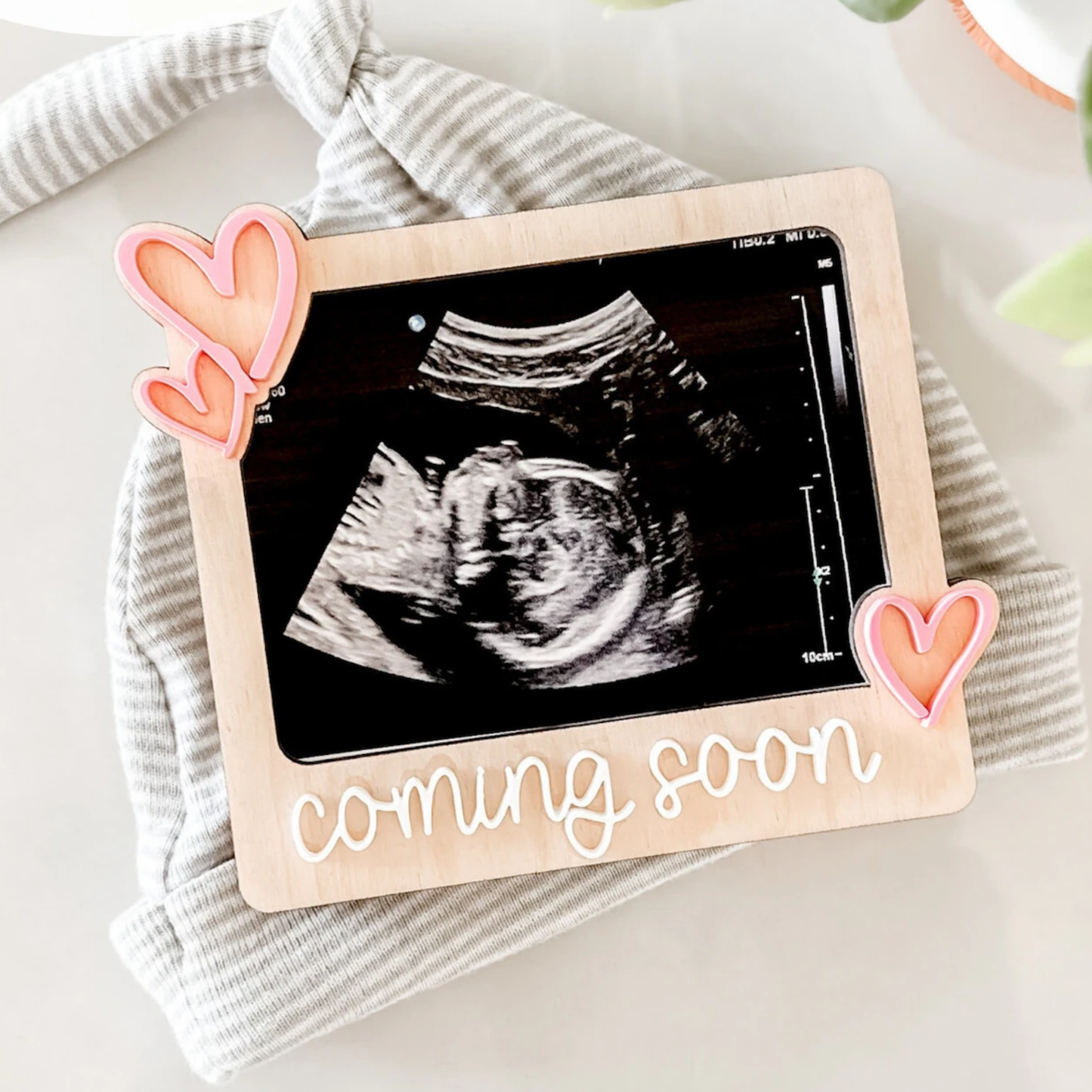 Pregnancy Announcement Ultrasound Fridge Magnet
